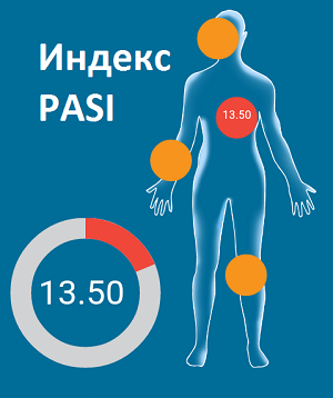 Индекс PASI