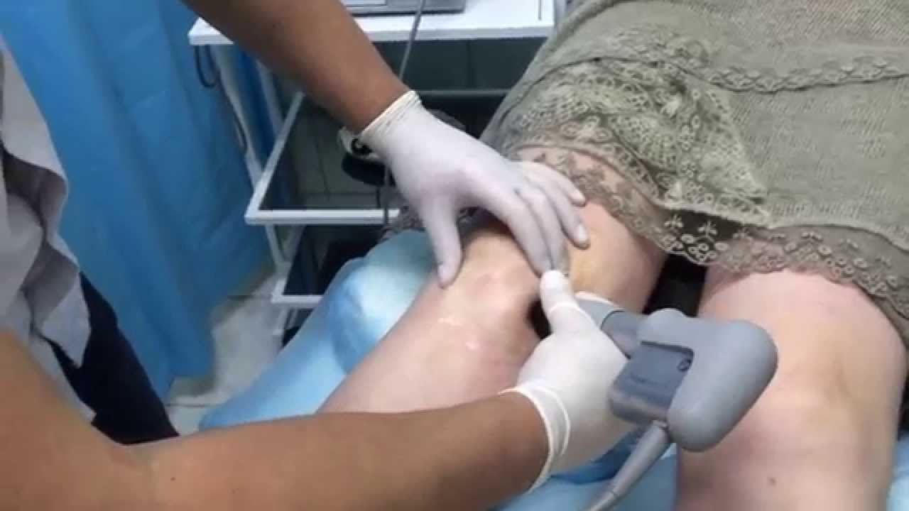 Физиотерапия