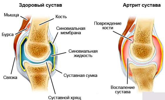 схема колена