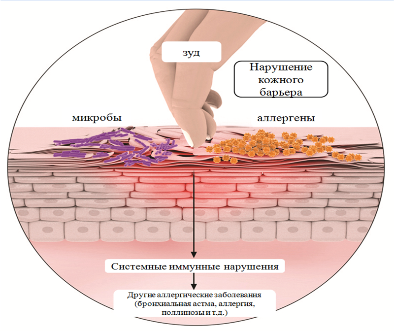 схема заражения