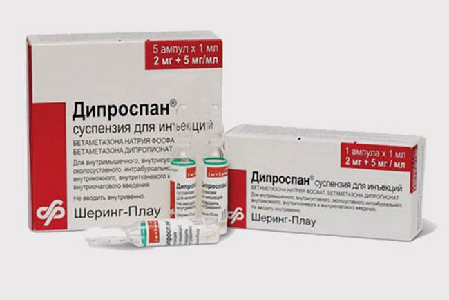 уколы Дипроспан