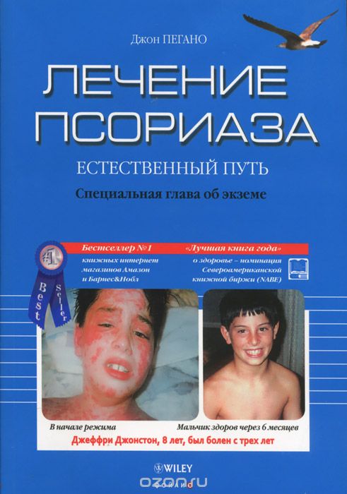 «Лечение псориаза. Естественный путь» Джон Пегано