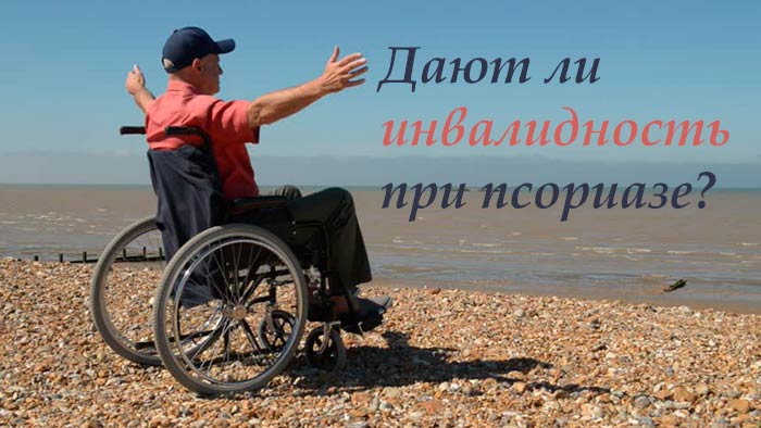 Дают ли инвалидность при псориазе: какие документы собрать и как ...