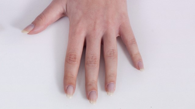 psoriaisis-artrit-start