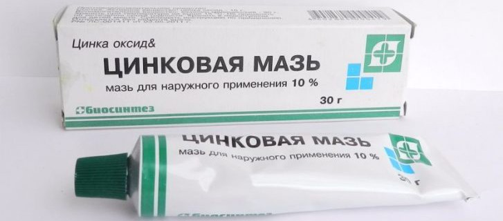 Псориаз у детей: фото начальной стадии болезни, причины и лечение
