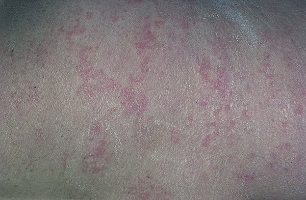 2.bZso0