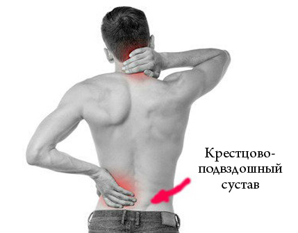 боль в пояснице при сакроилеите