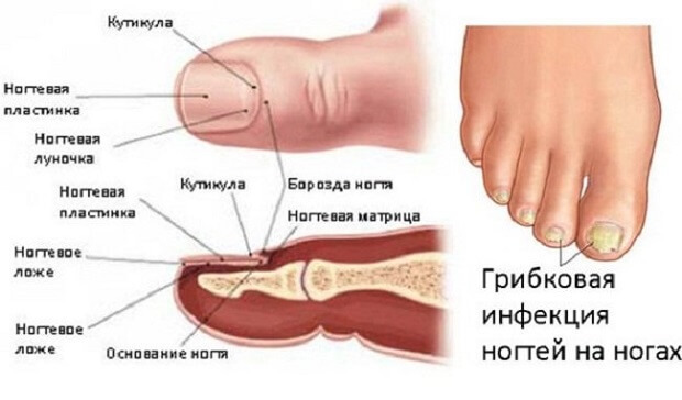 Сыпь на ладонях: высыпания в виде пузырьков, лечение
