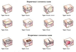 Вторичные элементы