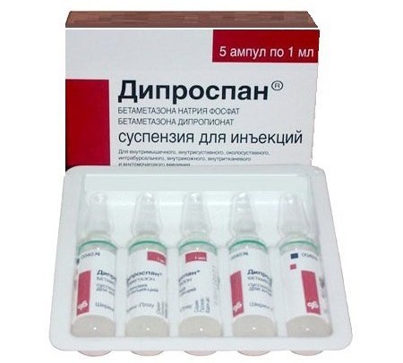 Дипроспан аналоги и заменители: чем заменить уколы в ампулах