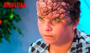 Я стесняюсь своего тела новообразование на голове
