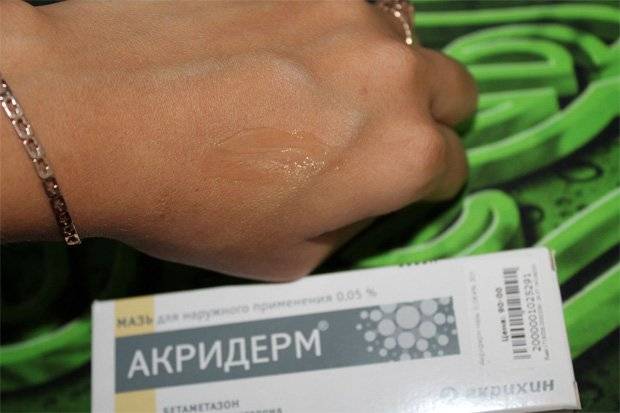 Человек демонстрирует мазь Акридерм на руке