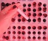 Скрытый сифилис - причины, симптомы, диагностика и лечение