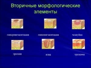 Вторичные элементы