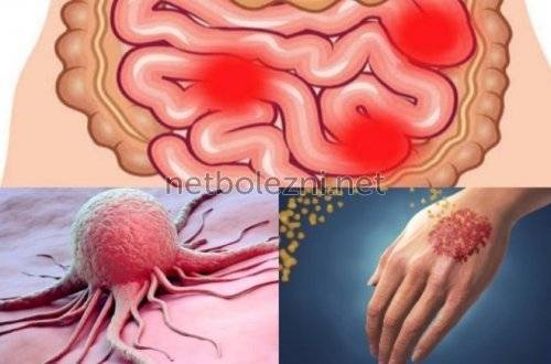 Бефунгин инструкция по применению