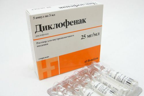 Сакроилеит: что это такое, симптомы, лечение, прогноз, препараты
