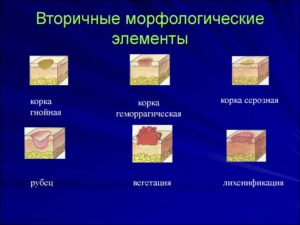 Вторичные элементы