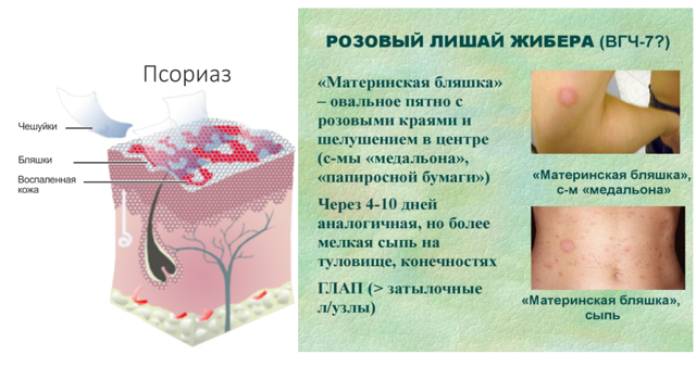 Почему появляются красные зудящие пятна на теле?