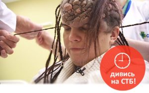 Я стесняюсь своего тела новообразование на голове