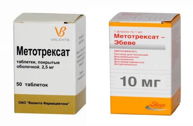 Псориатический артрит: симптомы, лечение, фото