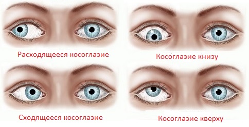 Болезни глаз у призывника
