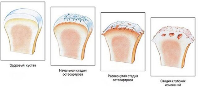 Симптомы с каждым днем становятся все более ярко выраженными 