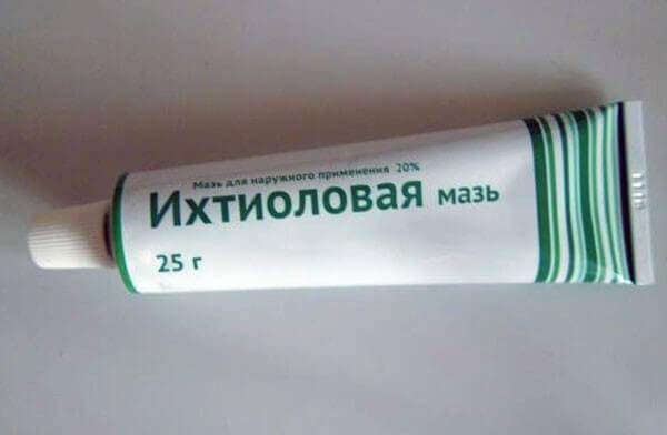 Каплевидный псориаз - ихтиоловая мазь