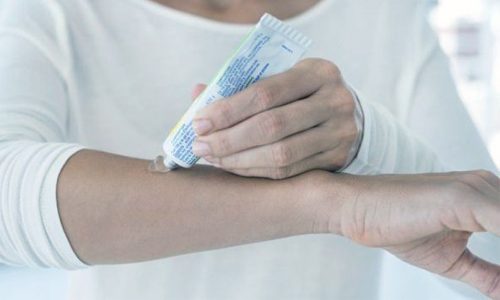 Лечение псориаза мазями