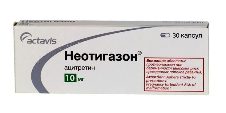Неотигазон для лечения псориаза