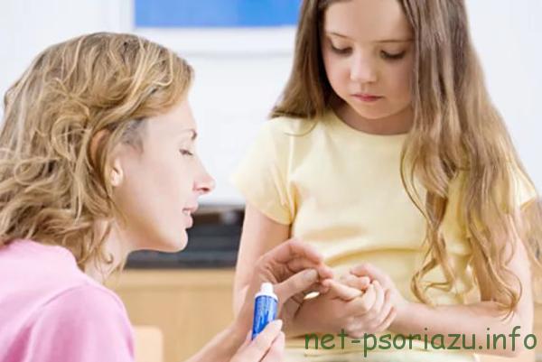 Цинокап среди детей