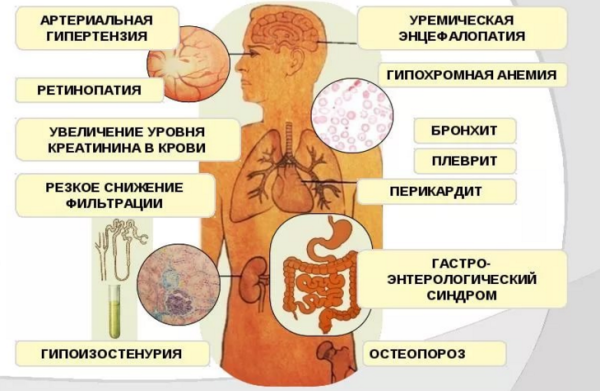 Признаки почечной недостаточности