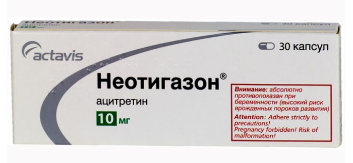 неотигазон