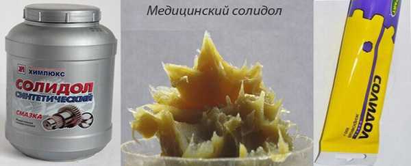 kak-izbavitsya-ot-psoriaza