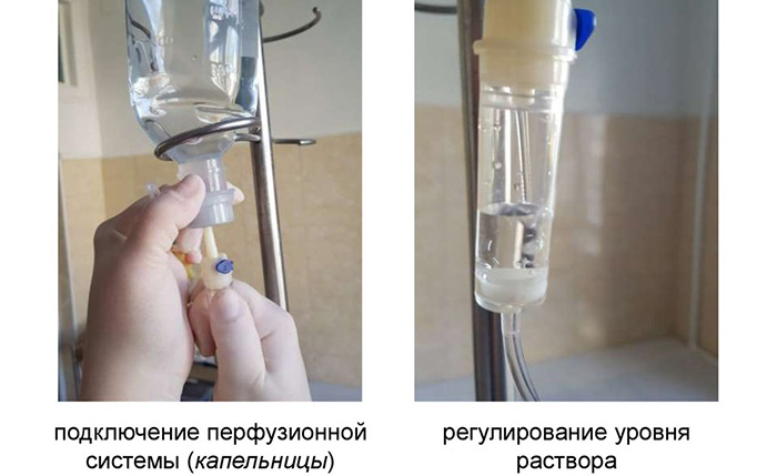 Внутривенная инфузия