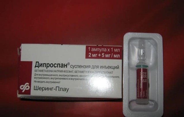 Уколы при артрите в сустав и внутримышечно - лечение инъекциями