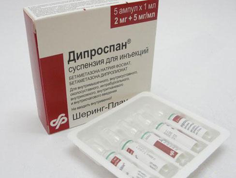 Уколы при артрите суставов: виды и применение