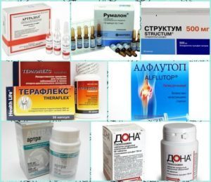 Уколы при артрите в сустав и внутримышечно - лечение инъекциями