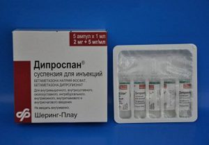 Дипроспан аналоги и заменители: чем заменить уколы в ампулах