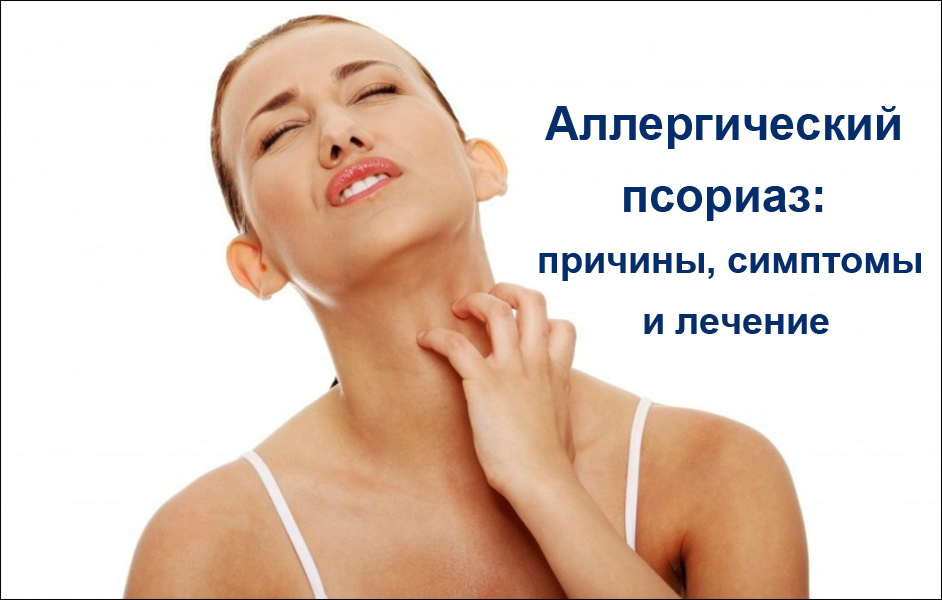 Аллергический псориаз