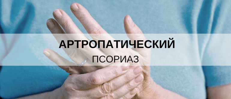 Псориатическая артропатия: симптомы и лечение суставов