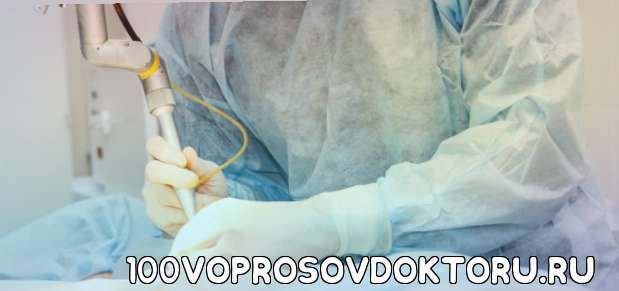 тех случаях, когда заболевание перешло в хроническую форму и консервативная терапия не дает результата, помогут радикальные методы, в частности удаление геморроя лазером