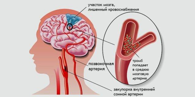 Показания и противопоказания для проведения массажа. абсолютные и временные причины для отказа от массажа