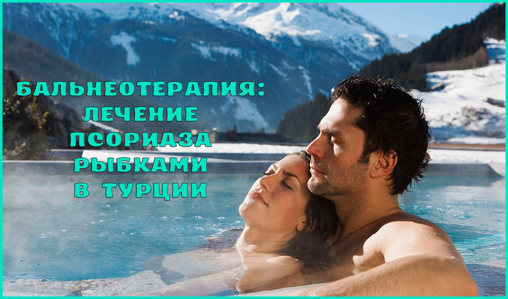 Лечение псориаза в Турции