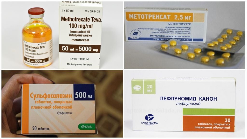 Ревматоидный артрит симптомы причины лечение