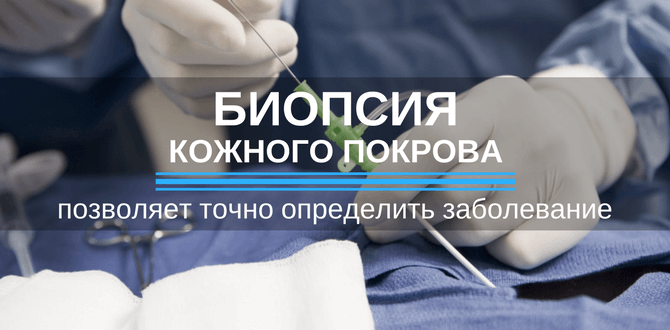 биопсия кожного покрова