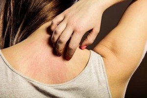Люди стесняются летом носить открытую одежду