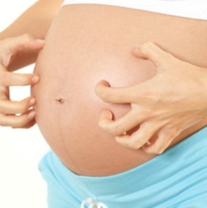 Передается ли псориаз от родителей детям и с какой вероятностью?