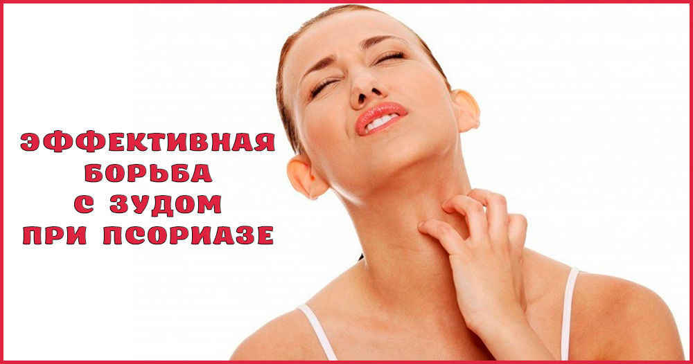 Чем и как снять зуд при псориазе