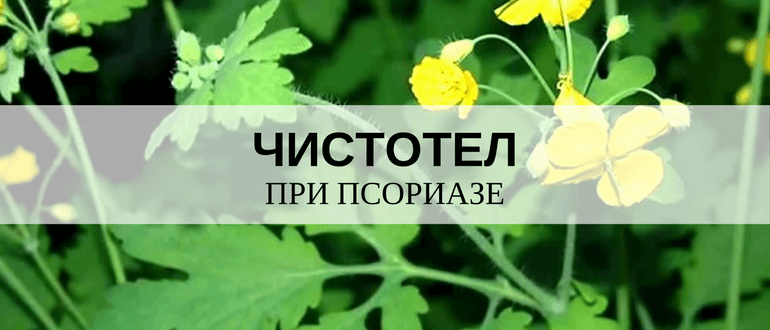 Масло чистотела от псориаза
