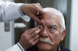 Дают ли инвалидность за отсутствие одного глаза
